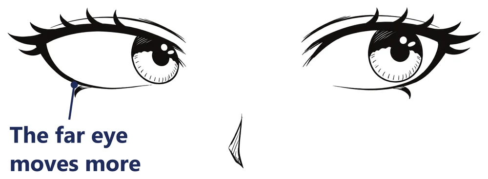 Two eyes looking sideways, labeled the far eye moves more